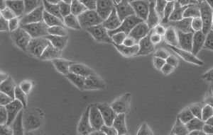 16-molecularoncology_HeLa-cells_Primo-Vert